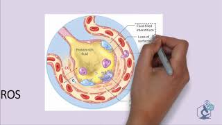 Understanding Covid19 and how to stay safe !!! (Animated Video)