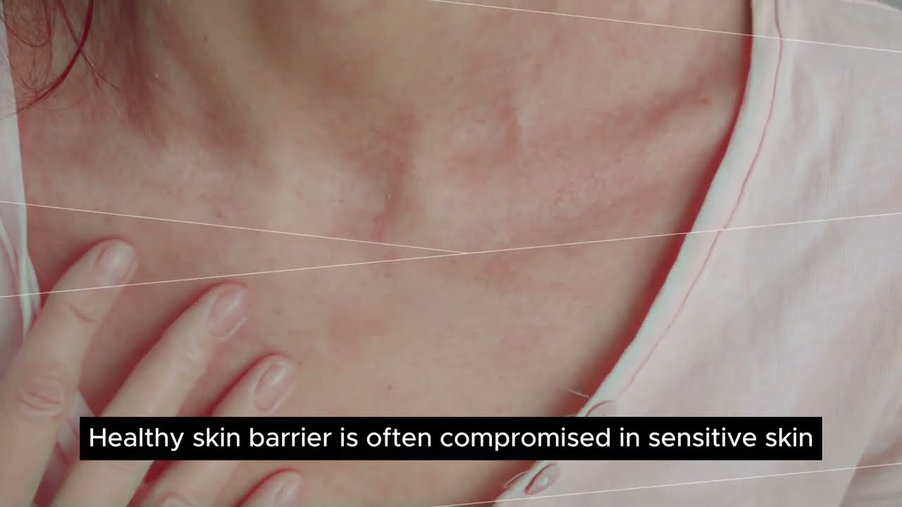 T𝗵𝗲 𝟯:𝟭:𝟭 𝗰𝗲𝗿𝗮𝗺𝗶𝗱𝗲-𝗱𝗼𝗺𝗶𝗻𝗮𝗻𝘁 𝗳𝗼𝗿𝗺𝘂𝗹𝗮 𝗮𝗻𝗱 𝗵𝗼𝘄 𝗱𝗼𝗲𝘀 𝘁𝗵𝗶𝘀 '𝗴𝗼𝗹𝗱𝗲𝗻 𝗿𝗮𝘁𝗶𝗼' 𝗵𝗲𝗹𝗽 𝗿𝗲𝗽𝗮𝗶𝗿 𝘁𝗵𝗲 𝘀𝗸𝗶𝗻 𝗯𝗮𝗿𝗿𝗶𝗲𝗿?