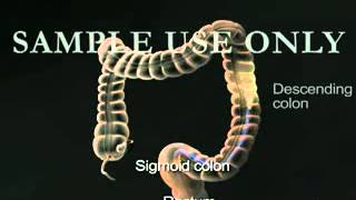 YouTube - 3D Medical Animation Lower GI Colonoscopy Sigmoidoscopy