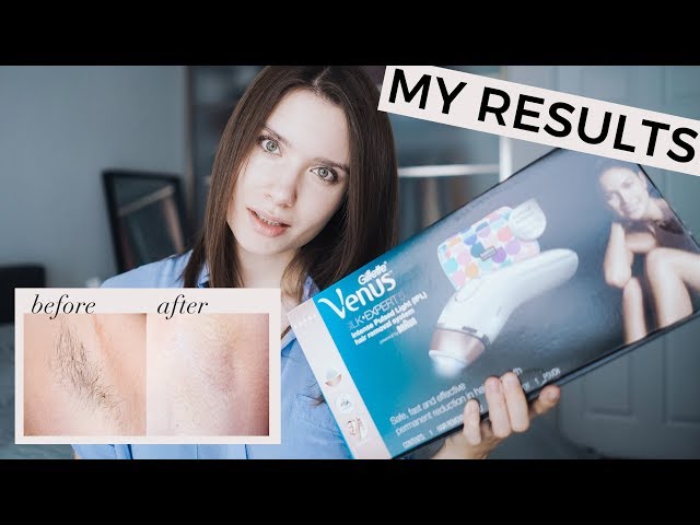 MY RESULTS - LASER HAIR REMOVAL AT HOME