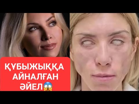 Video: Коаксиалдык кабелди кантип ажыратып, ажырата аласыз?