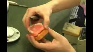 Denture Lining