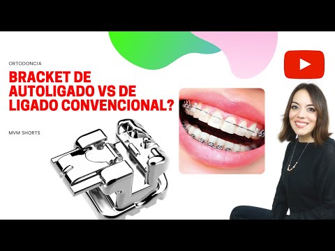 CONOCES cómo es
