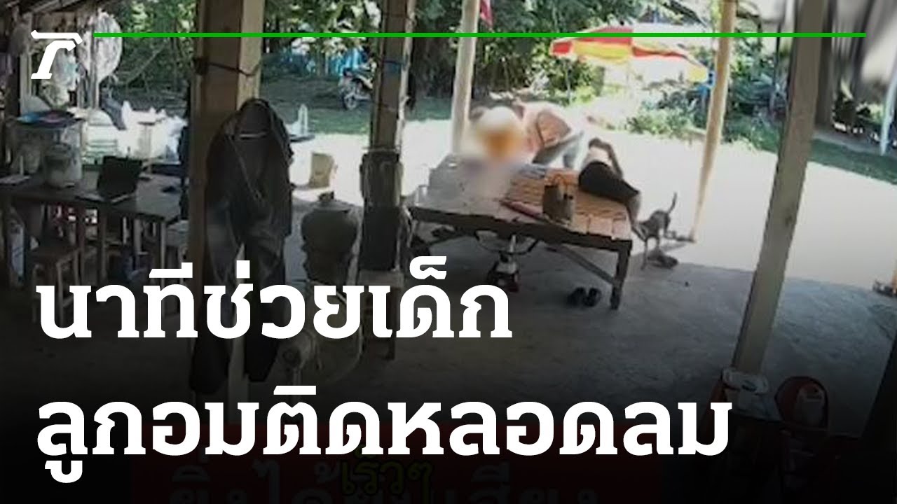 นาทีชีวิต ช่วยเด็กลูกอมติดหลอดลม | 01-11-64 | ข่าวเช้าหัวเขียว | สรุปข้อมูลที่สมบูรณ์ที่สุดเกี่ยวกับอาหาร ติด หลอดลม