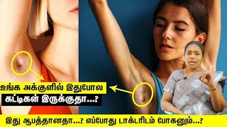 உஙக அககளல கழபப கடட இரககத..? அத ஆபததனத எபபத டகடரடம பகணம Armpit Lumps