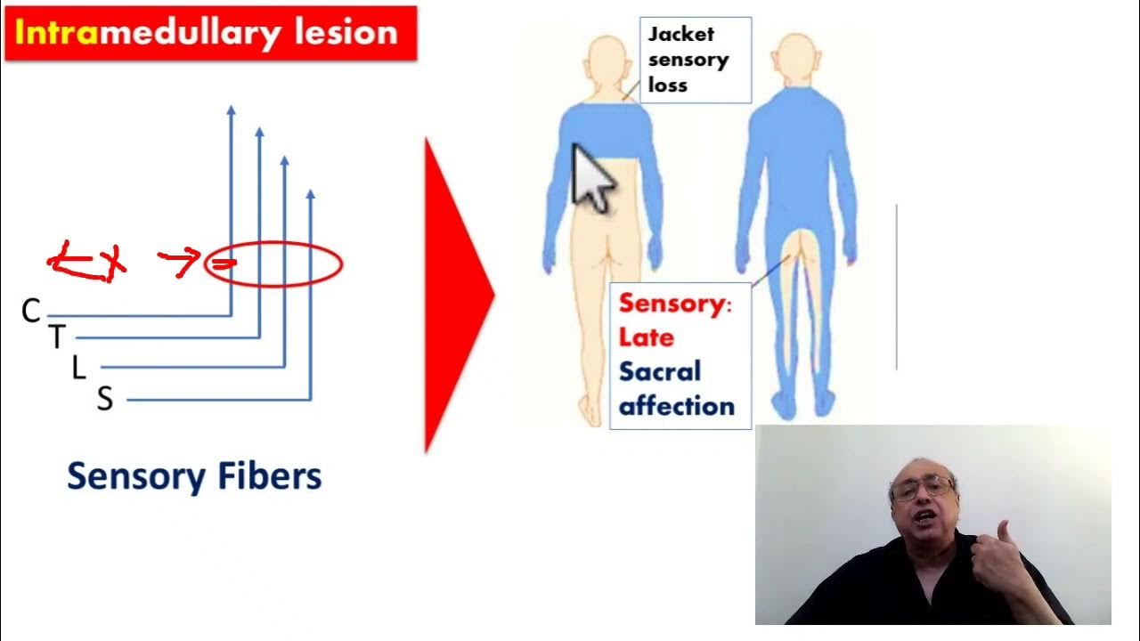 Neurology [Spinal Cord Compression] (Types) usmle internal_medicine 