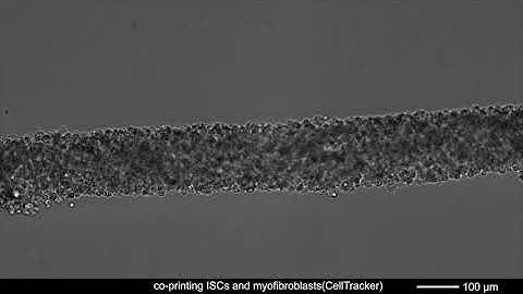 Supplementary Movie 6: Multicellular self-assembly of intestinal epithelial and stromal cells