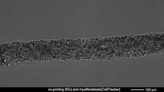 Supplementary Movie 6: Multicellular self-assembly of intestinal epithelial and stromal cells