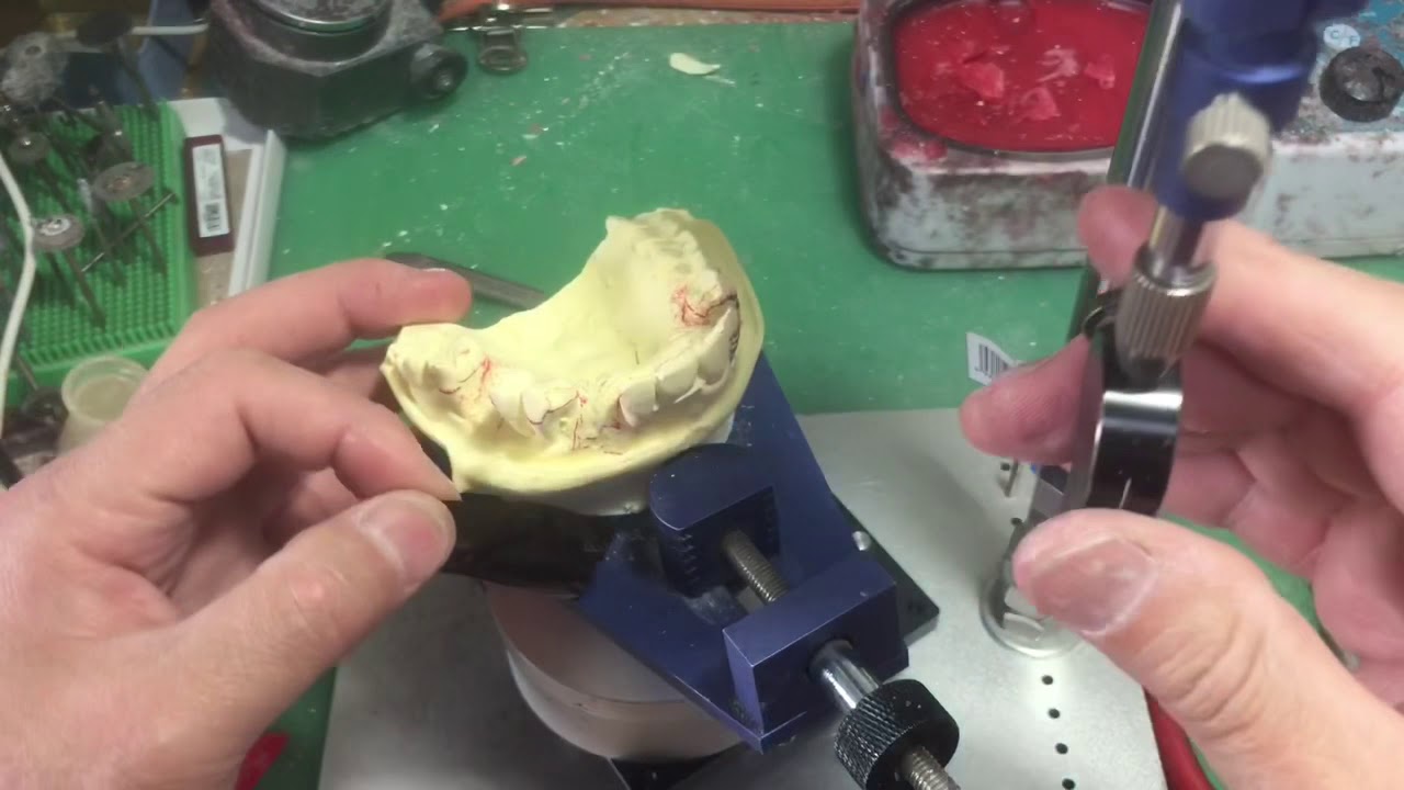 GC コノメーター 中古美品 歯科用測定器 歯科 技工 GC コノメーター 中古