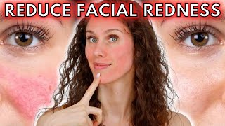 5 Reasons Your Face Is Always Red (Rosacea to Dermatographia & Everything Inbetween!)