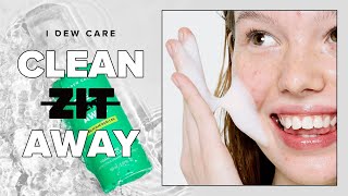✨Clean Zit Away | Meet the Best Acne Cleanser✨ | I DEW CARE