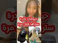 حيوانات نادرة ستراها لأول مرة في حياتك عالم الحيوان اغرب من الخيال معلومات عامة 