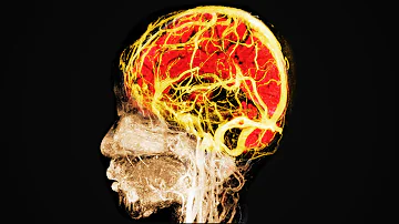 A Girl Ate 96 Gummy Edibles. This Is What Happened To Her Brain.