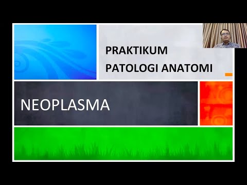 Praktikum Patologi Anatomi Neoplasma Umum
