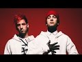 Twenty One Pilots Billboard Chart Achievment Winners -- Acceptance Speech [2017]