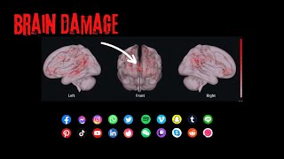 Social Media Is Giving You Brain Damage