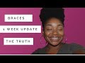THE TRUTH ABOUT BRACES | 1 WEEK UPDATE