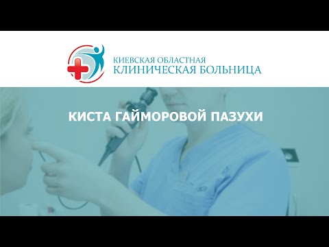 Киста гайморовой пазухи