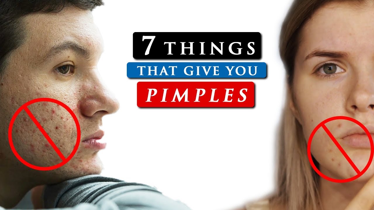 What Causes Pimples On Your Face And How To Get Rid Of It