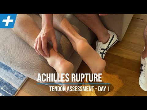 Achilles Tendon Rupture - Day 1 | Tim Keeley | Physio REHAB