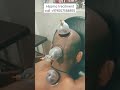 Hijama Therapy for Hairloss | Hijama center in kolkata | #shorts #short #subscribe #sunnah