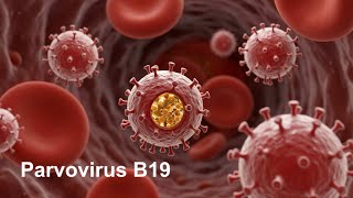 Parvovirus B19 [DNA, Naked, Single-stranded, Parvoviridae]