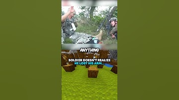 Soldier Doesn’t Realize He LOST His Arm… 😢