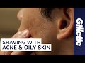 How to Shave with Acne and Oily Skin | Men's Skin Care Tips