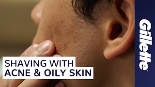 How to Shave with Acne and Oily Skin | Men