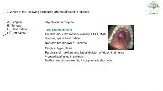 Oral Pathology Doubts - IV, Explainer Videos screenshot 2