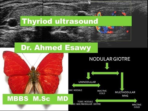 Thyroid ultrasound Imaging Dr.Ahmed Esawy