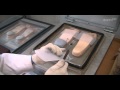 알푸스 발보조기 제작 (alFOOTs foot orthotic making)