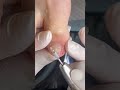 【肥厚爪ケア】#shorts