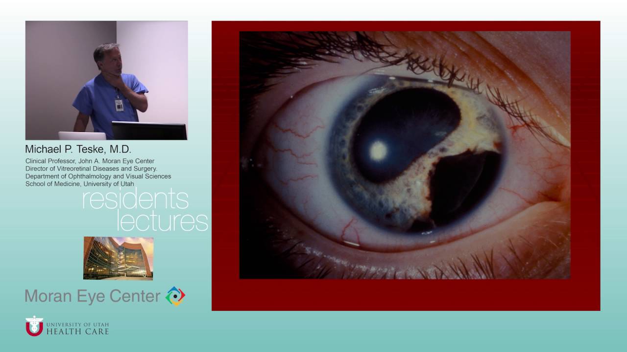 http://clinicaltrials.gov Posterior Segment Trauma