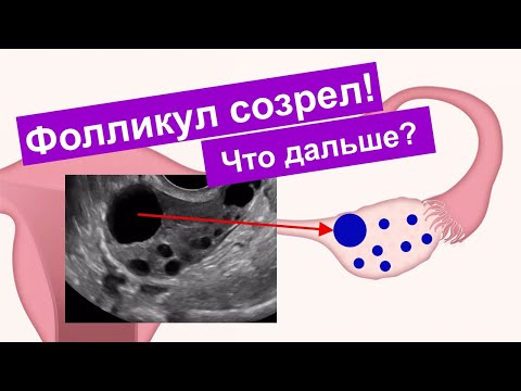 Видео: Когда неоплодотворенная яйцеклетка выходит из организма?