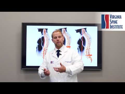 Understanding Flatback Syndrome I Presented by Spine Surgeon Dr. Christopher Good