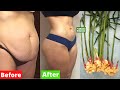 How to Lose Belly Fat Permanently Fast I No Strict Diet No Exercise I