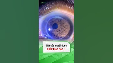 Mắt của người được ghép giác mạc |#shorts
