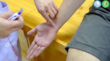 Cách xác định vị trí các huyệt thường dùng vùng chi trên