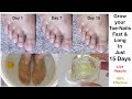 Grow your Toe-Nails fast and long in just 15 days || Faster Nail Growth || Mamtha Nair