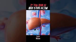 간 기능 장애 시 몸이 보내는 5가지 신호 #아약 #건강정보