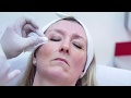 MATA Harley Street - Injectable Training Courses Patient Preparation