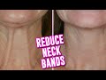 HOW TO REDUCE NECK BANDS AT HOME WITHOUT SURGERY | 4 EASY TIPS!
