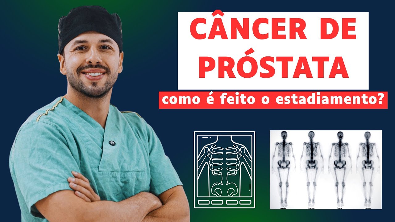 Descobri um CÂNCER DE PRÓSTATA! Próximo passo: ESTADIAMENTO!