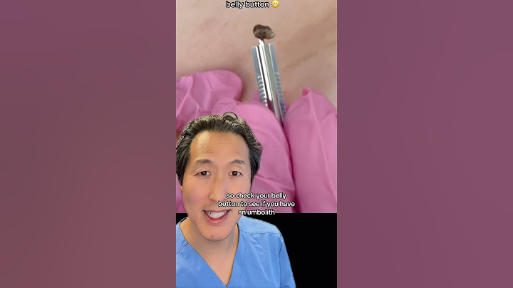 Do You Have a Rock in Your Belly Button? #bellybutton