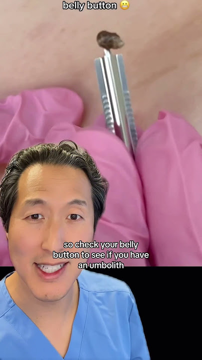 Do You Have a Rock in Your Belly Button? #bellybutton
