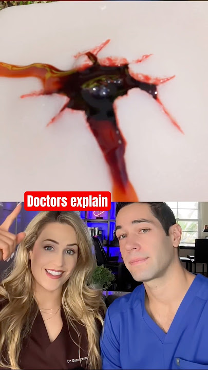 Download lagu How to prevent bleeding out