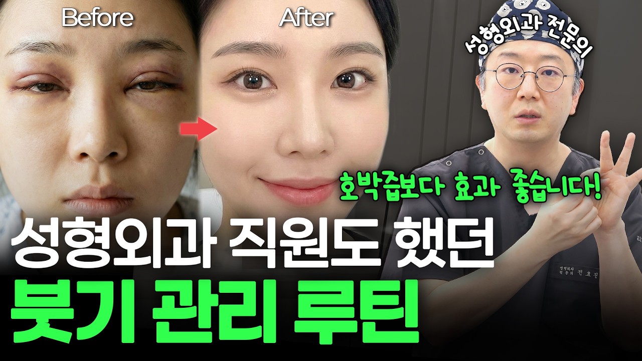 [ENG/JPN] 눈수술 붓기, 언제 빠지나요? 성형외과 전문의가 알려주는 붓기 관리의 정석 (ft. 소세지눈 탈출)
