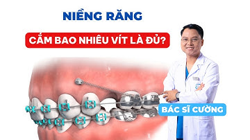 Niềng Răng Cần Cắm Bao Nhiêu Vít? Giải Đáp Chi Tiết |Dr Cường Official