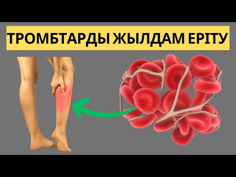 Лера Лера есінен танып қалды Жас жұбайлардың жыныстық қатынасқа түсуі туралы бейне